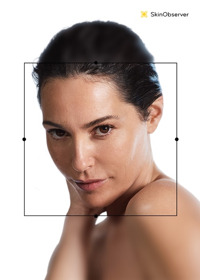 NAOS SkinObserver